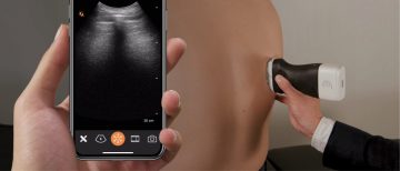 UBC News: UBC researchers develop portable ultrasound scanner network for COVID-19